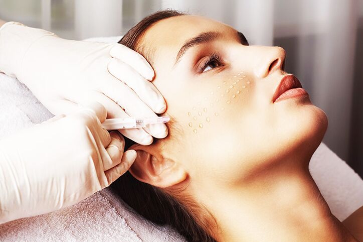 A biorevitalizáció az arcbőrfiatalítás egyik hatékony módszere