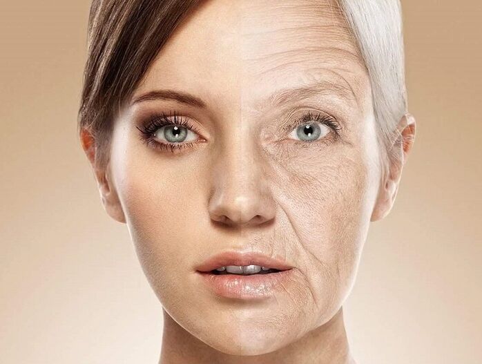 arcbőr lézeres fiatalítás előtt és után